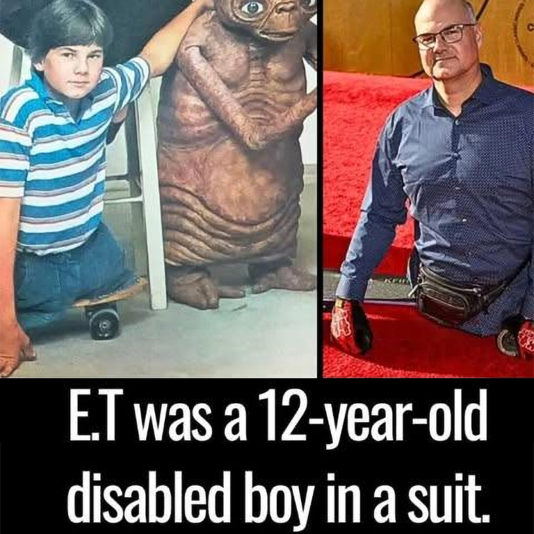 et 768